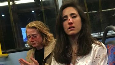 En libertad bajo fianza quedaron sospechosos del ataque a dos mujeres en Londres