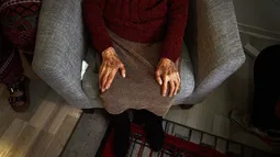 La adulta mayor de 83 años a quien Serviu aprobó un subsidio y luego lo rechazó exponiéndola a desalojo: Corte ordenó otorgarlo