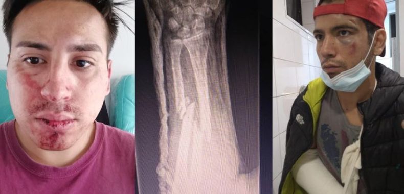 Agresion pareja gay Movilh 820x394 1.jpg