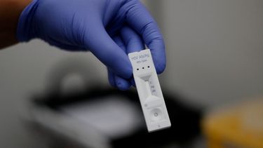 Pacientes deben esperar hasta 7 horas para acceder al test rápido del VIH en consultorios