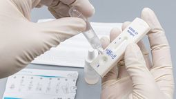 COVID-19: Francia comenzará a vender en farmacias auto test para detectar coronavirus