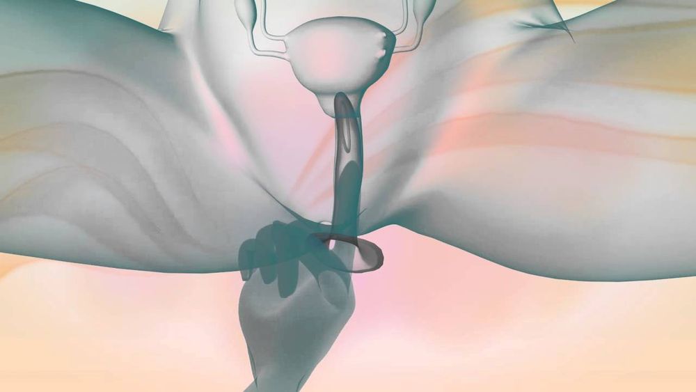 Antofagasta: Fundación Margen distribuye condones femeninos a trabajadoras sexuales
