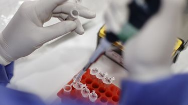 Gremios del ISP piden a ministra Aguilera medidas por brote de bacteria en laboratorio