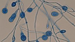 Por ahora, el equipo se concentra particularmente en la fase de descripción y caracterización de los hongos. Por ahora, el equipo se concentra particularmente en la fase de descripción y caracterización de los hongos.