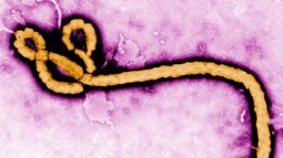 Captura de pantalla de un video que muestra el virus Ébola Captura de pantalla de un video que muestra el virus Ébola