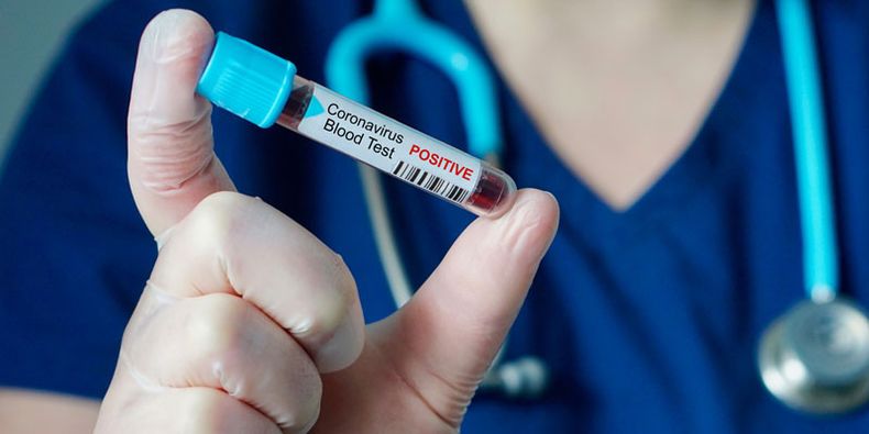 Coronavirus en Brasil..jpg