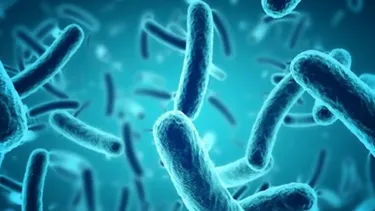 Alerta alimentaria por listeria en queso de cabeza: Aumentan regiones donde se ha detectado la bacteria