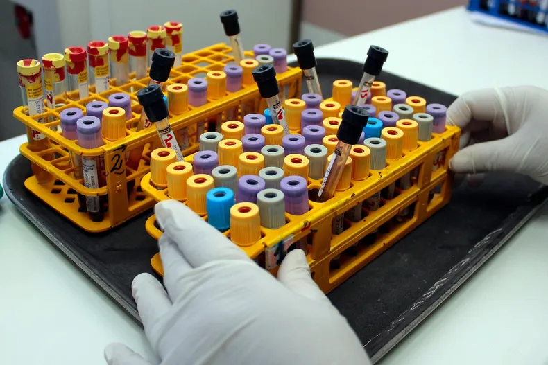 30496 a uno 399596.webp