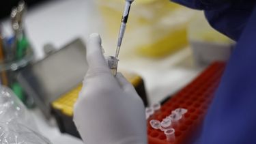Viruela del Mono: Ministerio de Salud confirma segunda persona fallecida en Chile