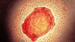 Viruela del mono: Argentina confirma oficialmente su primer caso infectado