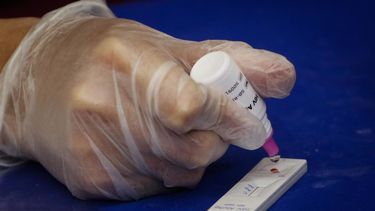 Oficial: Confirman al tercer paciente del mundo que se cura del VIH