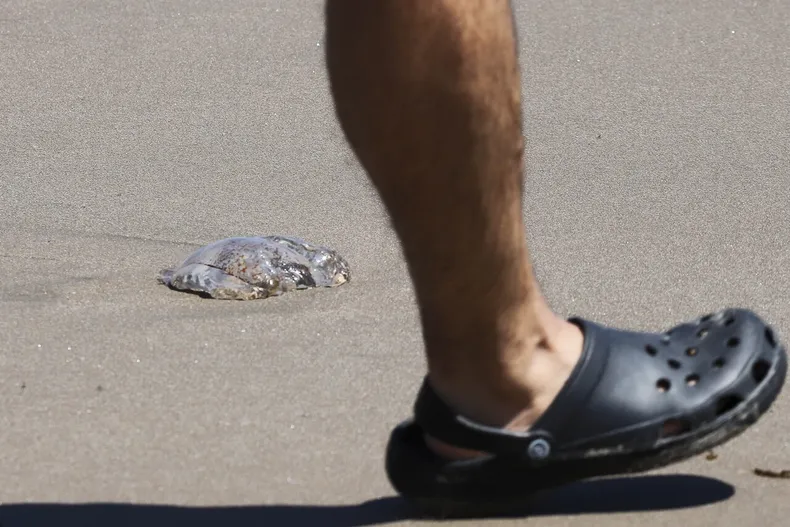 alerta por fragata portuguesa en playas de chile sintomas que pueden requerir atencion medica y que hacer ante una picadura.webp