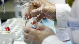 ISP ordena retiro de todo el suero fiosiológico del Laboratorios Sanderson por contaminación microbiológica