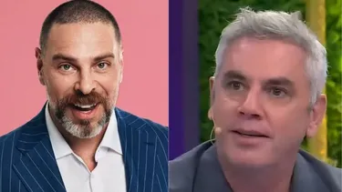 Boom del implante capilar: los famosos chilenos que se lo han hecho y en qué consiste el procedimiento