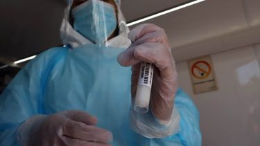 Virus Nipah: Alerta en la OMS por potencial epidémico de enfermedad en la India