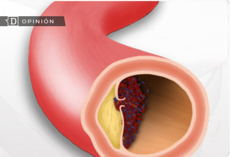 Enferemdad de Kawasaki e1706200557774.png