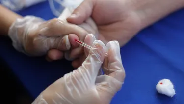 Científicos identifican una hormona que provoca Diabetes tipo 2 en personas obesas