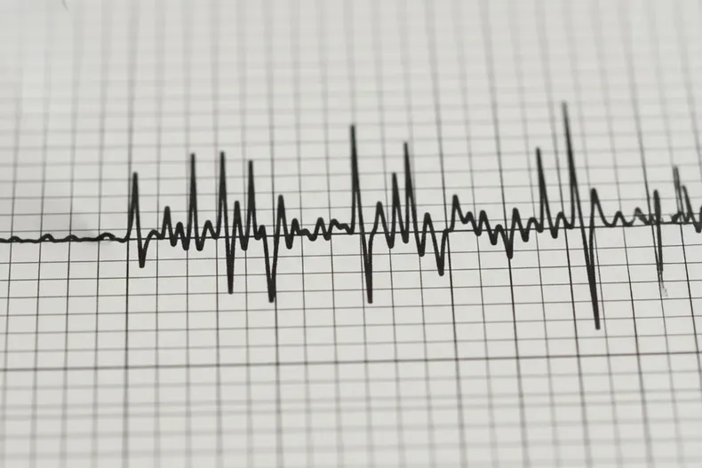 31150 a uno 1710056.webp