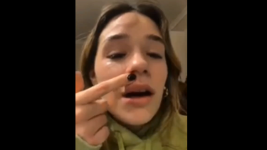 Te puedes morir: Alessia relató llorando accidente que sufrió por seguir peligroso juego