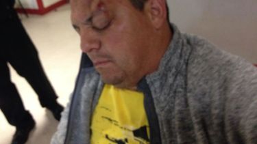 No aprendieron nada: Carabineros deja en riesgo vital a un hombre por chorro de carro lanzaaguas