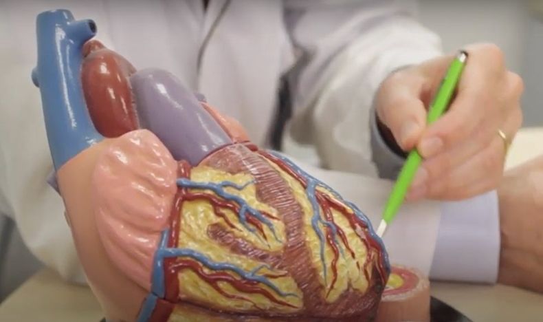 Miocardiopatia.jpg