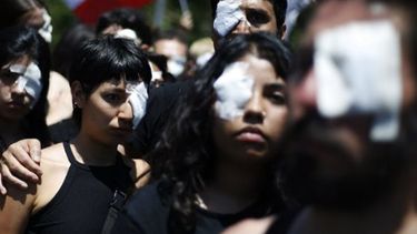 El Desconcierto | Lesiones oculares imagen referencial.jpg