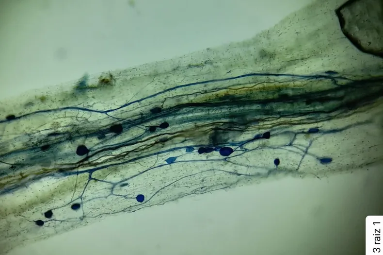 11366 micorriza en microscopio 1.webp