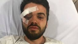 Jugador argentino de la selección gay de rugby sufre brutal ataque homofóbico