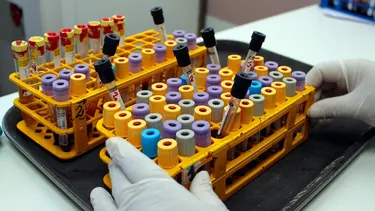 Hombre de 60 años muere por virus Hanta en Limache: Autoridad sanitaria realiza investigación epidemiológica