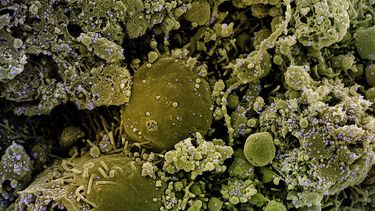 Dos estudios vuelven a apuntar al mercado de Wuhan como epicentro del Covid