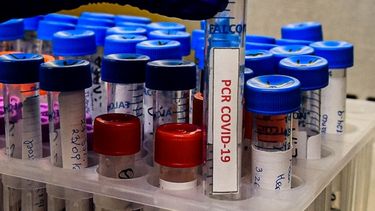 COVID-19, cifras globales: La pandemia anota triste récord de más de un millón de víctimas fatales