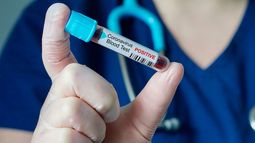 Brasil reconoce que primer fallecido por coronavirus en ese país fue hace más de dos meses