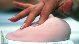 Desigualdades de género empeoran el acceso de las mujeres a la prevención del cáncer