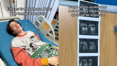 VIDEO| Tiktoker experimenta fatídico efecto de consumir 2 litros diarios de Coca Cola