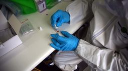 OMS se disculpa y aclara confusión en torno a tratamientos con hidroxicloroquina para enfrentar el COVID-19