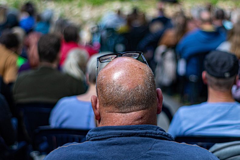 the balding gaef0c691a_1280.jpg