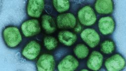 Los casos globales de viruela del mono se acercan a la barrera de los 10.000
