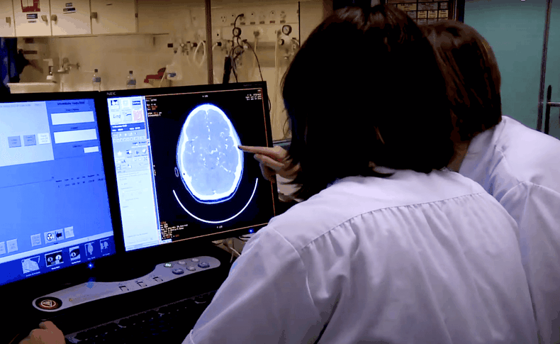 en chile cada hora muerte una persona por un acv  enfermedad afecta a 40 mil por ano.png