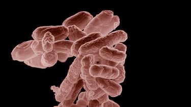 Niño murió en Curanilahue por contraer la bacteria Escherichia coli - Captura de video&nbsp;