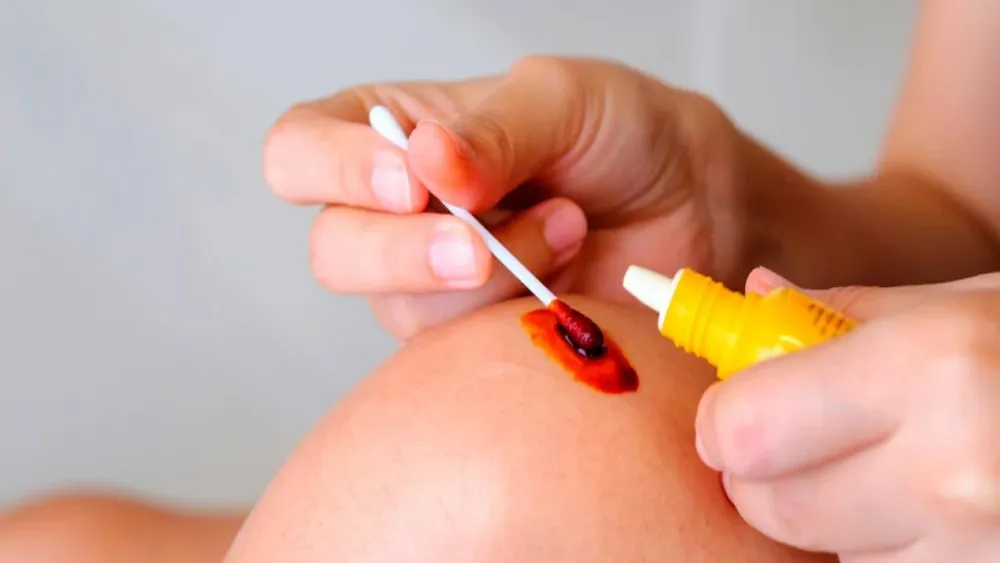 ISP informa retiro voluntario de povidona por unidades que no cuentan con su etiquetado: Revisa detalles del fármaco