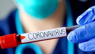 Estudio advierte que la Hidroxicloroquina no protege contra el COVID-19