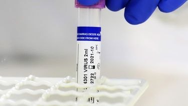 COVID-19: Estados Unidos ilustra cómo operará la distribución de las primeras dosis de la vacuna