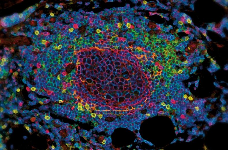 Nature metastasis.jpg