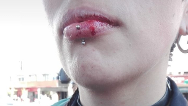 Concepción: Mujeres denuncian que fueron golpeadas por seguidor de Kast durante marcha por el Día Nacional contra el Femicidio