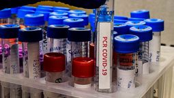 COVID-19, cifras globales: La pandemia anota triste récord de más de un millón de víctimas fatales