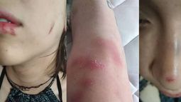 Pateadas en el suelo y azotadas contra la pared: Pareja de mujeres sufre brutal ataque en Barrio Bellavista