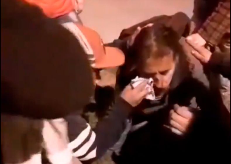 Disparo en el ojo.jpg