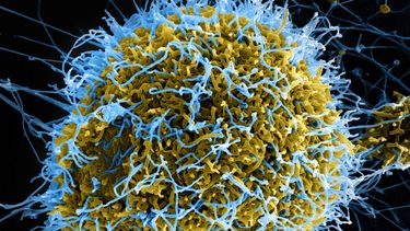 República Democrática del Congo confirma un nuevo caso de ébola en el noreste del país