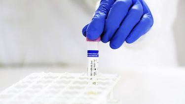 EE.UU. compra casi la totalidad de la producción del primer fármaco para tratar el COVID-19